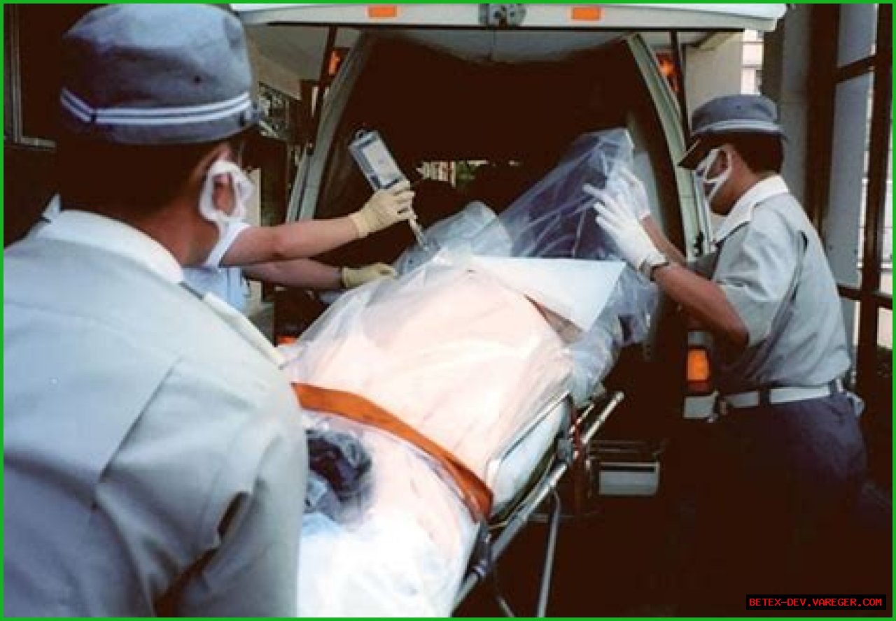 Exploring Hisashi Ouchi: A Look At The Life Through Photos